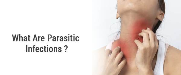 What Are Parasitic Infections