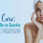 What Can I Do to Quickly Remove Pimple?