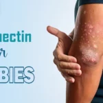 Ivermectin for scabies