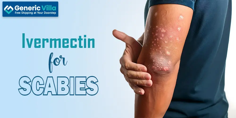 Ivermectin for scabies